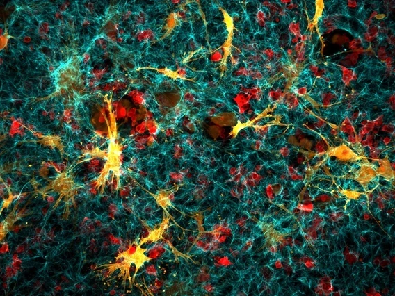 An image of confocal cancer cells and fibroblasts in collagen